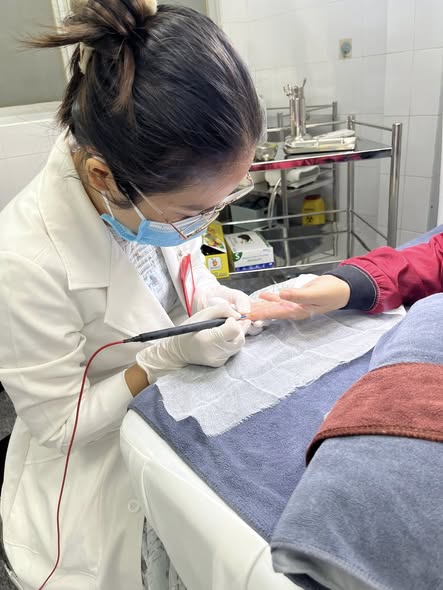 🌸 ĐỐT MỤN CÓC BẰNG MÁY ĐIỆN CAO TẦN - BỆNH VIỆN QUÂN Y 4