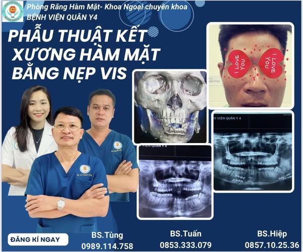  Phẫu thuật kết xương hàm dưới hai bên bằng nẹp vis